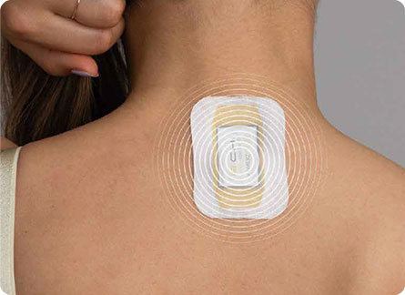 Frekvenční čip e.CHI aplikovaný na krční páteř